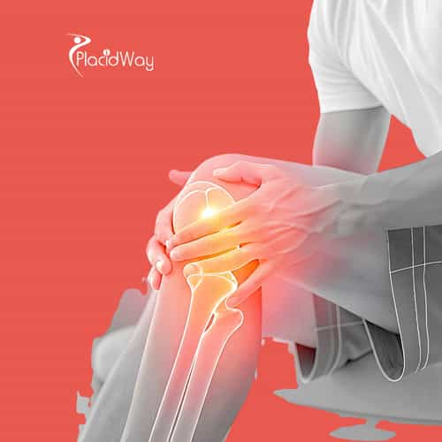 Stem Cell Treatment for Joint Pain in Turkey for Munich Patients 